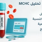 تحليل MCHC